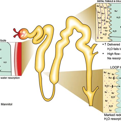 (PDF) Osmotic nephrosis with mannitol: Review article