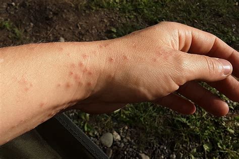 Mainers Could Be Haunted By the Browntail Moth Rash This Fall