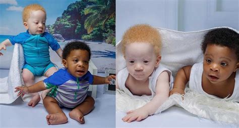 Nigerian Mom Shares Unique Story of Black & White Twins | CafeMom.com