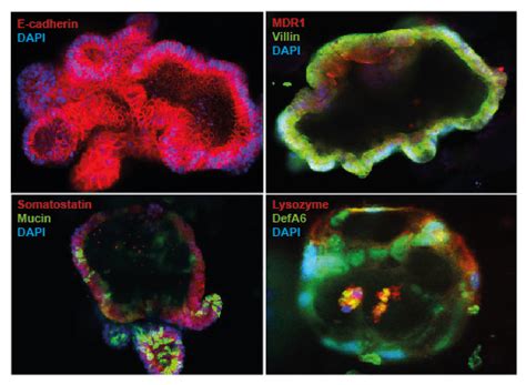 Human Intestinal Organoids, iPSC Derived Products | DefiniGEN