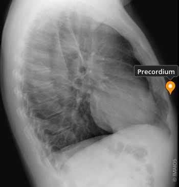 Precordium - e-Anatomy - IMAIOS