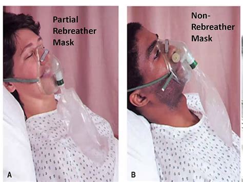 Difference Between Partial Rebreather Mask And Non Rebreather Mask