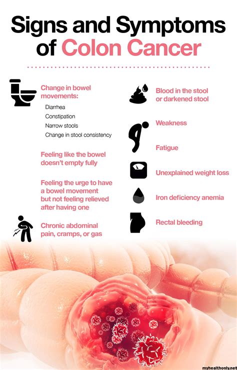 Symptoms of Colon Cancer, Risk Factors and Causes - My Health Only