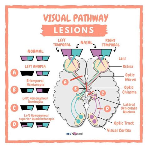 Visual Pathway Anatomy | sexiezpix Web Porn