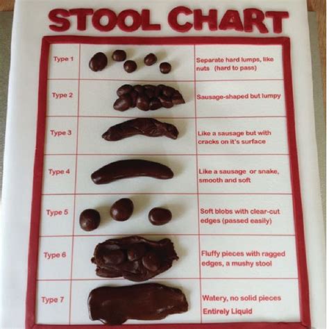 Colon Cancer Stool Color Chart