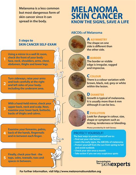 Melanoma Skin Cancer and Self Examination Melanoma Foundation - Premier Dermatology Atlanta