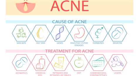 Acne: Understanding the Cause and Treatment