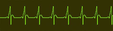 Heart Ecg Gif