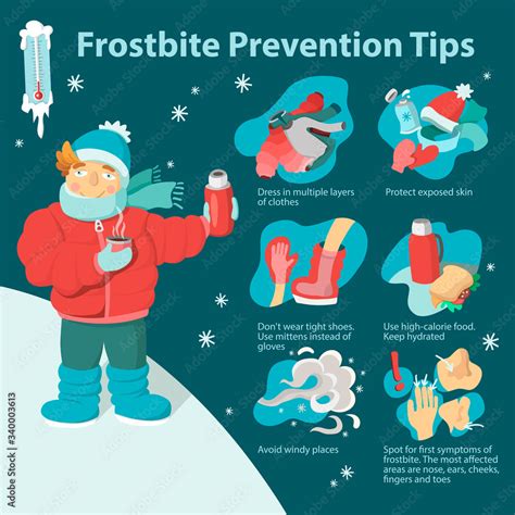 Frostbite prevention tips. Cartoon infographic, poster or flyer. Stock ...