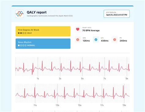 PR Interval on Your Watch ECG - Short, Normal, and Prolonged | Qaly