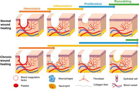 Stages Of Wound Healing Overview, Process Timeline Video, 52% OFF