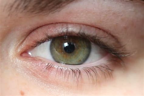 What Is the Rarest Eye Color in the World? - Skin Care Geeks