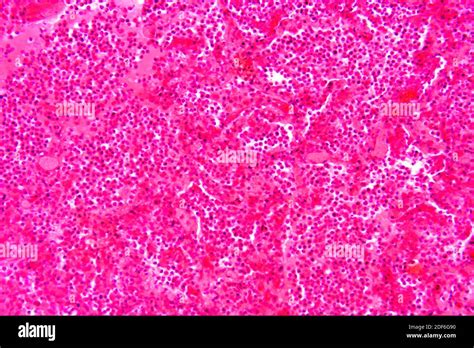 Mycobacterium tuberculosis microscope hi-res stock photography and ...