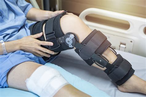 Do I Need to Wear a Knee Brace After ACL Surgery? — Dr. Bill Sterett