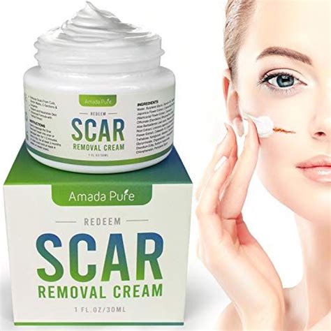 15 Best Scar Removal Creams Of 2020 – Reviews And Buying Guide in 2020 | Acne scar removal cream ...