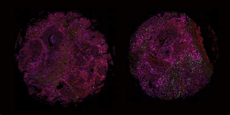 Clinical Implications of Multiplex Imaging | Visikol