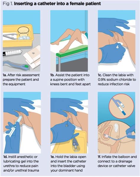 Catheter Care Chart