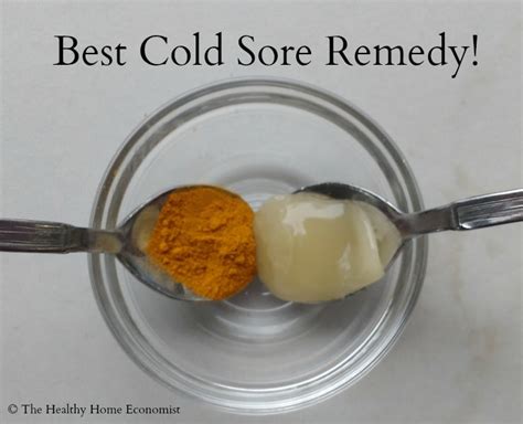 Effective Home Remedies for Cold Sores | Healthy Home Economist