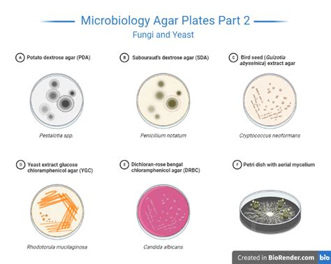 Agar Plates- Definition, Composition, Types, Procedure - Sciencevivid