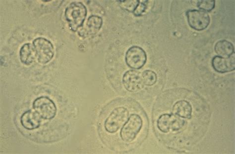 Urinalysis