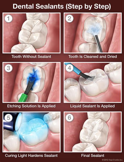 Early Dental Care