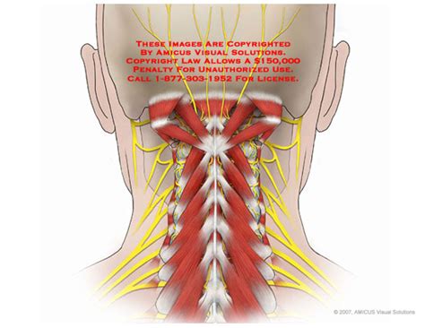 Posterior Neck Anatomy(4)