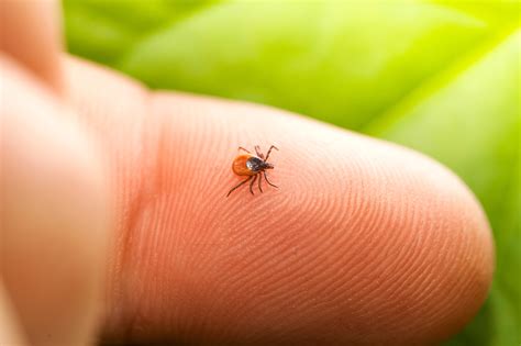 Tick Bites: Learn the Signs, Symptoms and Treatment