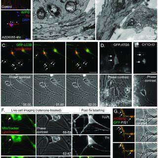 Example images of autophagy and mitophagy assays in dopaminergic ...