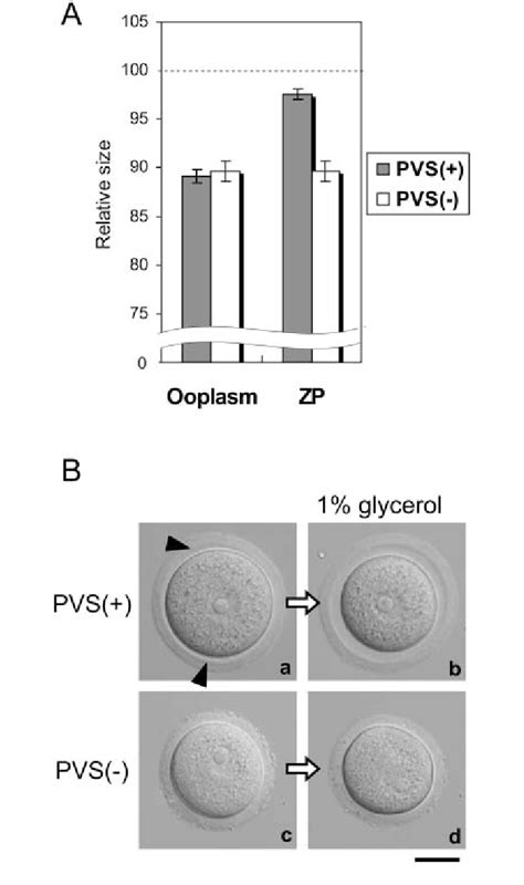 Dissociation of the zona pellucida (ZP) from the p l a s m a m e m b r... | Download Scientific ...