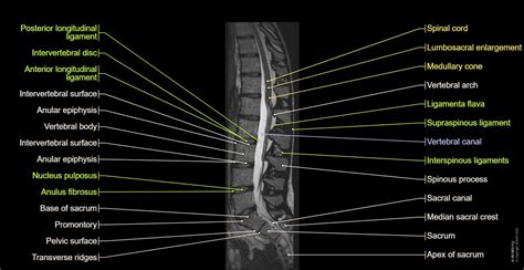 Anatomy of the lumbar vertebrae: normal anatomy | e-Anatomy