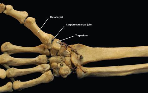 19.3 Joints and Skeletal Movement – Concepts of Biology 1st Canadian Edition- Gunness