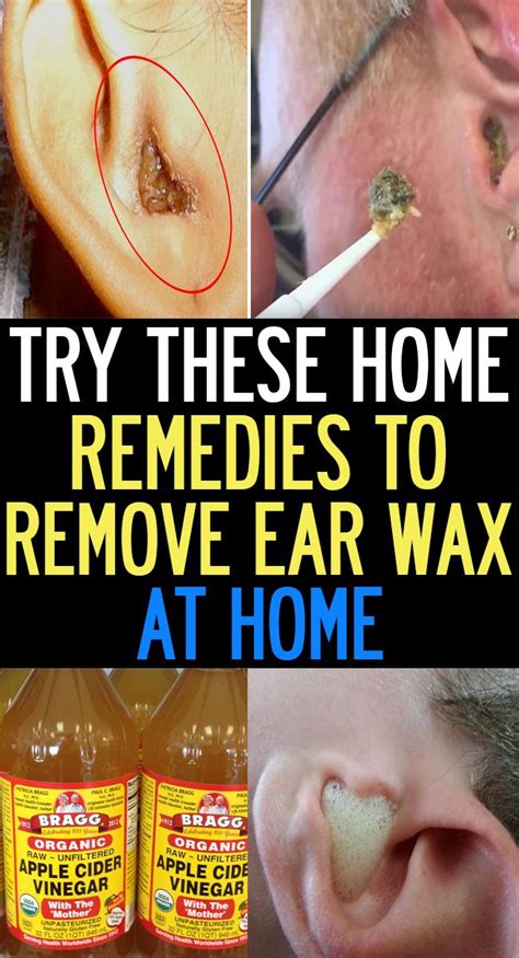 How Long To Remove Ear Wax - HOWOTREMVO