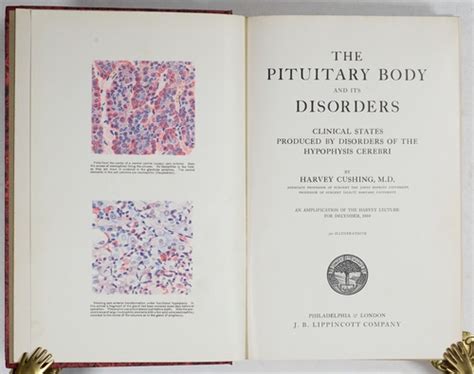 The pituitary body and its disorders; clinical states produced by disorders of the hypophysis ...