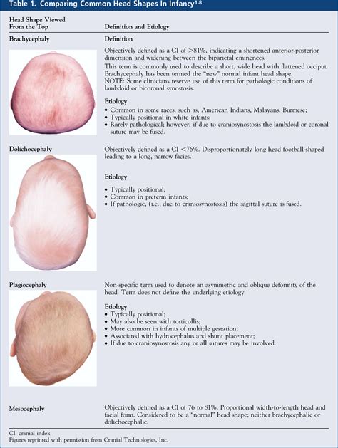 IMPACTING INFANT HEAD SHAPES | Semantic Scholar