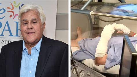 Jay Leno receives hyperbaric chamber treatment after he suffered ...