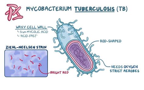 Mycobacterium tuberculosis (Tuberculosis): Video | Osmosis