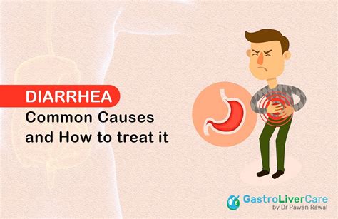 Chronic Diarrhea: Common Causes and How To Treat It - Gastro Liver Care