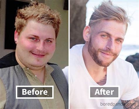 128 Surprising Photos of Face Fat Loss Before and After Weight Loss ...