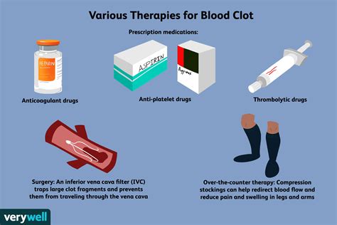 How To Cure A Blood Clot - Trackreply4