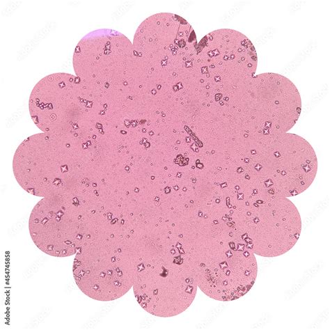 Light microscope of calcium oxalate crystals are shaped like envelopes ...