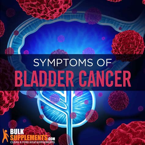 what causes bladder cancer Archives