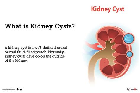 Kidney Cyst Ultrasound And Biopsy Procedure