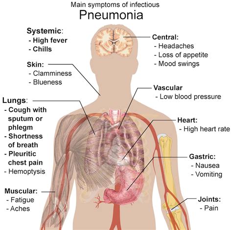 Pneumonia Virus Symptoms