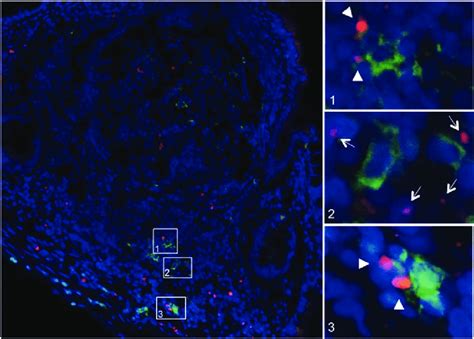 Fluorescence microscopy of Alexa Fluor 594-conjugated yeast-derived ...