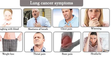 Symptoms of Lung Cancer on Different Stages - CancerOz