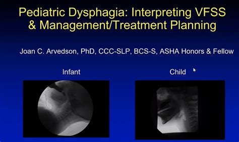 Pediatric Dysphagia Assessment and Treatment | Online SLP CEUs