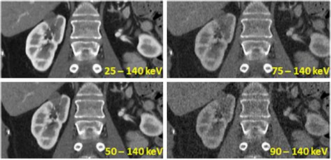 Contrast-enhanced kidney scan acquired with a preclinical photon... | Download Scientific Diagram