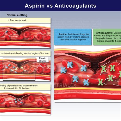 Aspirin vs Anticoagulants - TrialExhibits Inc.