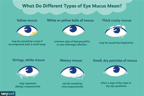 Types of Eye Discharge, Mucus, and Their Causes