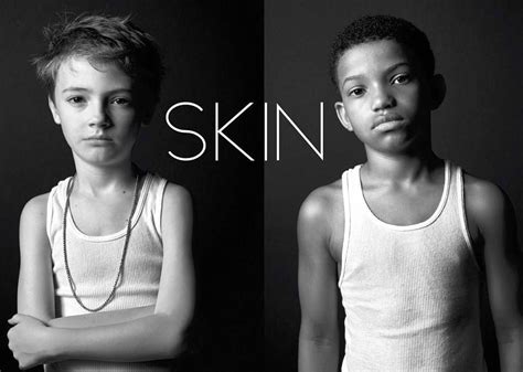 Skin Short Film Review